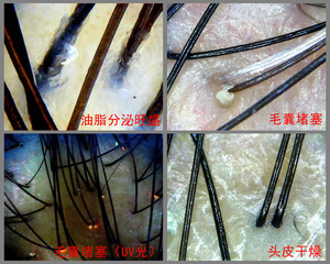 Productos para el Crecimiento del Cabello, Analizador del Cuidado del Cabello, Masaje para el Recrecimiento, Detección y Análisis del Cuero Cabelludo, Spa Capilar con Enfriamiento por Aire para el Recrecimiento del Cabello - Product Image 5