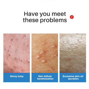 Exfoliante Facial Jabón de Coco 100g Limpieza Profunda Exfoliante Cuidado Suave Piel Sensible - Product Image 4