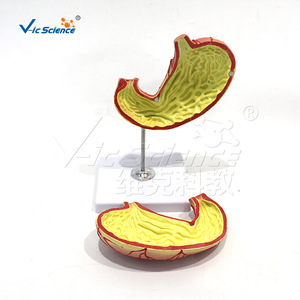 VIC-D021B Modelo de Estómago Natural Grande de 2 Componentes: Modelo de Enseñanza de Úlcera Gástrica Humana, Modelo de Enseñanza Patológica - Product Image 4