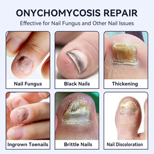 Liquido Riparatore per Unghie a Base di Erbe, Trattamento Antibatterico e Nutriente per Unghie di Mani e Piedi, Vendita all'Ingrosso - Product Image 5