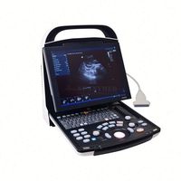 Sistema de Diagnóstico por Imágenes y Ecógrafo Mindray DP-30 Totalmente Digital con Carro