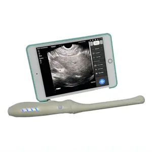Rechercher les fabricants des Ge Ultrasound Scanner produits de qualité  supérieure Ge Ultrasound Scanner sur Alibaba.com