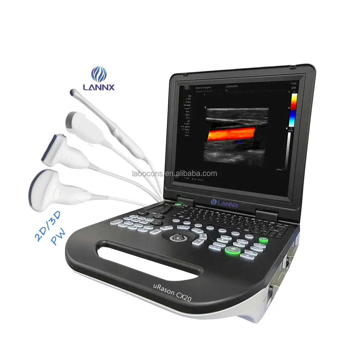 LANNX uRason CX20 Melhor Preço Sistema Portátil de Ultrassom Color Doppler ecografia digital completa 2d ultra-som para a gravidez