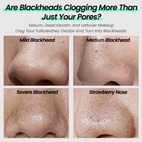 Bandes nasales nettoyantes en profondeur à la boue volcanique pour l'élimination des points noirs, masque facial minimisant les pores, patch nasal au charbon de bambou avec logo personnalisé