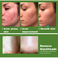 Sérum Visage Anti-Acné à l'Acide Salicylique OEM ODM : Contrôle Optimal, Inhibe les Boutons, Débouche et Répare les Pores
