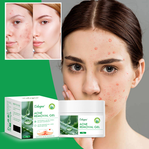 Crema Hidratante de <span class=keywords><strong>Aloe</strong></span> <span class=keywords><strong>Vera</strong></span> Natural Zaleyae, Desvanece Manchas, Antiacné, Reduce Poros, Nutre, Repara, Rejuvenece, Gel para el Cuidado Facial - Product Image 5