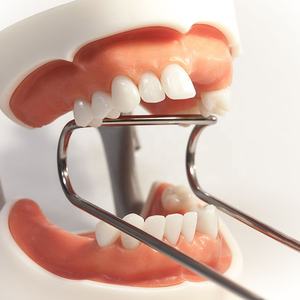 Strumenti chirurgici dentali in acciaio inossidabile Sternberg retrattori doppio lato bavaglio guancia e bocca apriscatole - Product Image 3