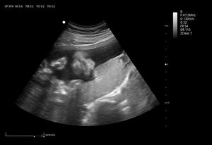 Ecógrafo Veterinario Zoncare Viv 60 con <span class=keywords><strong>Precio</strong></span> Económico, Doppler Color 3D y 4D con Carro para Hospital Veterinario - Product Image 3