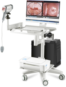 女性用ミニデジタルカメラビデオコルポスコープ - Product Image 2