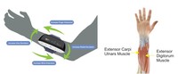 Équipement de rééducation pour la chute du bras et les AVC, XFT XFT-2003EA Classe II FES, pour usage domestique