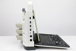 Medsinglong renkli doppler ultrason makinesi ecocardiografo tıbbi ultrason aletleri taşınabilir 4D 5D ultrason tarayıcı