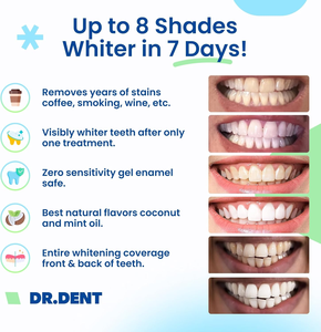 Tiras Blanqueadoras de Dientes <span class=keywords><strong>en</strong></span> Gel para Uso Doméstico, Pegamento para Reparación de Dentaduras y Pintura Bucal, Paquete <span class=keywords><strong>en</strong></span> Caja, Marca Privada - Product Image 4