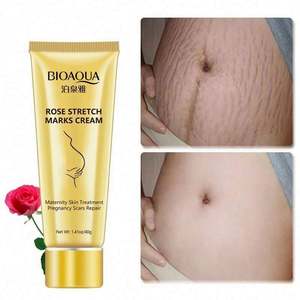 Marque privée OEM Crème anti-vergeture personnalisée pour dissolvant d'essence d'herbes après la <span class=keywords><strong>grossesse</strong></span> Vente en gros - Product Image 5