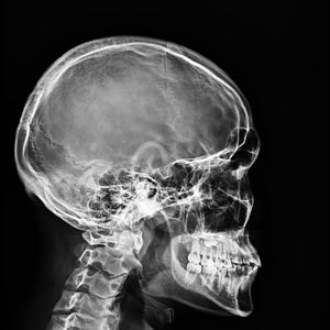 Équipement de radiologie médicale 17*17 Machine à rayons X Portable numérique sans fil détecteur à écran plat prix pour une utilisation humaine ou vétérinaire - Product Image 5