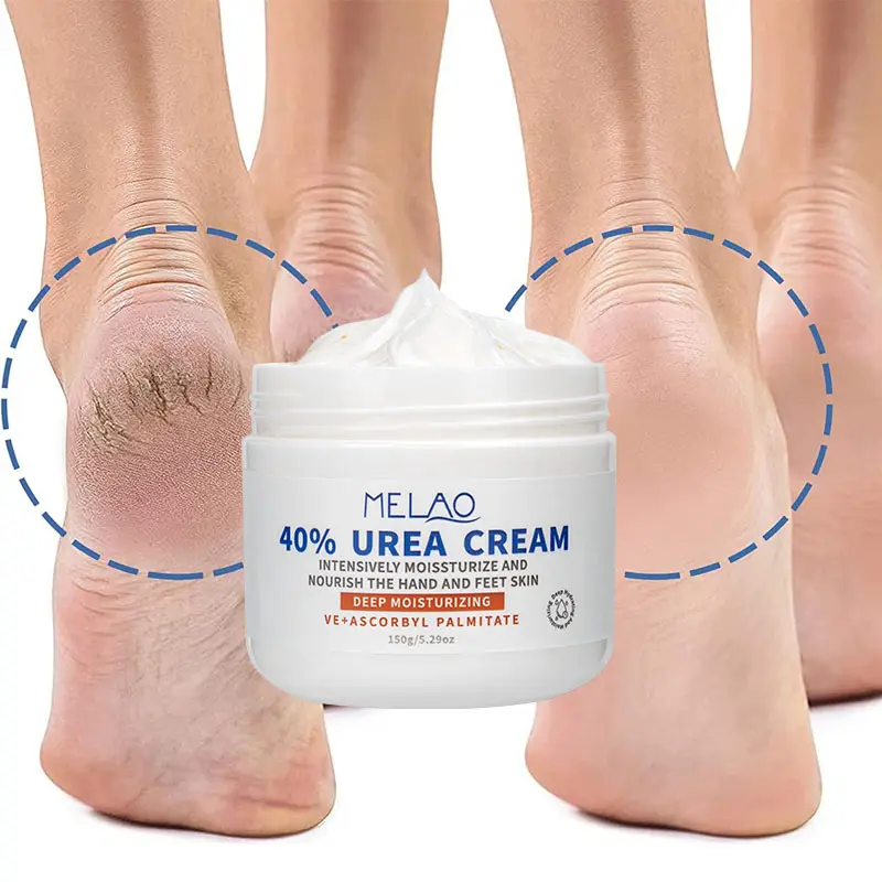 Feet Maximum Strength Dry Cracked Urea Foot Cream 40 Per Urea Lotion Urea Cream 40 Percent