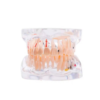 32 dientes mes completo implante enfermedad dientes modelo claro diseño implatn dientes estudio modelo dentsit uso patología dental modelo