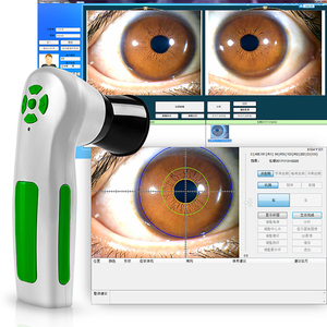 새로운 1200만 화소 USB 눈 진단 아이리스코프 좌우 램프 아이리스코프 아이리돌로지 카메라 눈 홍채 분석기 - Product Image 2