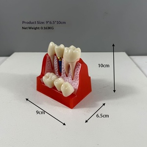 Modelo Dental MAXCARE MAC-L30 con Ampliación 6x y Implante para Enseñanza y Práctica Médica - Product Image 3