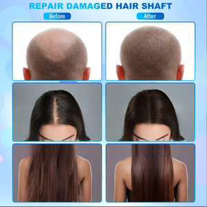 Analyseur <span class=keywords><strong>de</strong></span> cuir chevelu, <span class=keywords><strong>de</strong></span> cheveux et <span class=keywords><strong>de</strong></span> peau avec technologie intelligente IA, <span class=keywords><strong>massage</strong></span> par vibration, analyse faciale - Product Image 6