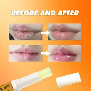 Private Label Kollagen erweicht hellt Lippen linien auf Feuchtigkeit spendende benutzer definierte 5g Honey Bee Lip <span class=keywords><strong>Balm</strong></span> - Product Image 5