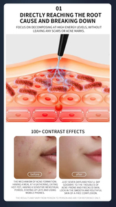 Dispositivo de Belleza con Ondas Magnéticas para Uso Doméstico, Elimina Manchas y Lunares, Rejuvenecimiento Facial, Restauración de la Vitalidad de la Piel, Reafirmación - Product Image 2