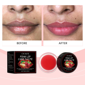 Tarro <span class=keywords><strong>de</strong></span> bálsamo labial <span class=keywords><strong>de</strong></span> vitamina E rosa <span class=keywords><strong>de</strong></span> 10g para eliminar <span class=keywords><strong>labios</strong></span> <span class=keywords><strong>de</strong></span> humo oscuro Gel <span class=keywords><strong>de</strong></span> bálsamo labial mineral nutritivo Natural - Product Image 1