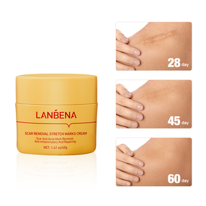 แลนเบนา ครีมลดรอยสิว รอยแผลเป็น รอยแตกลาย ซ่อมแซมผิว - Product Image 2