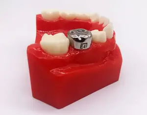 UM歯科矯正用ステンレス鋼小児用歯冠乳歯臼歯冠5個/箱 - Product Image 6