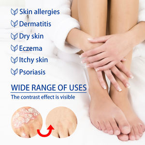 Crème en Gros Marque Blanche à Base de Plantes pour Dermatite Prurit Psoriasis Infection Fongique Urticaire Plaques Pommade Anti-démangeaisons - Product Image 6