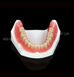 Prothèses complètes en acrylique personnalisées de haute qualité à bas <span class=keywords><strong>prix</strong></span>, pouvant être retirées pour être nettoyées, nettoyage plus pratique - Product Image 6