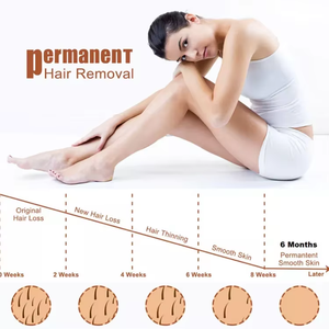 Máquina Profesional de Depilación Láser OPT SHR IPL, Rejuvenecimiento Cutáneo No Invasivo, Equipo Estético - Product Image 3