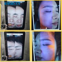 Analyseur de peau intelligent numérique pour détection d'hydratation du visage, utilisation en SPA, machine d'analyse cutanée 3D IA personnalisée