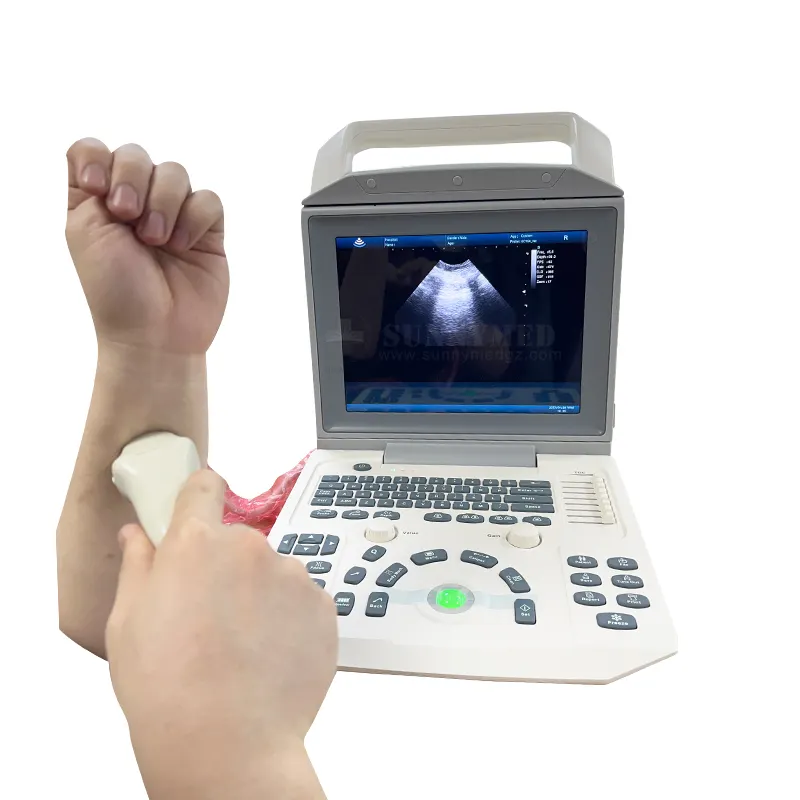 Veteriner için SYA-150_Vet taşınabilir ultrason 12.1 inç dokunmatik ekran arabası renk ultrason 3d makinesi at köpek eşek
