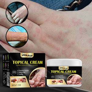 Crema Tópica para Ampollas por Sudor, Picaduras de Mosquitos, Picazón Seca, Nutritiva, Reparadora de la Piel, con Vitamina E, para Uso Corporal, 30g, Antipruriginosa para Manos y Pies - Product Image 3