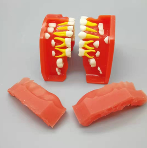 Modèle alternatif de développement buccal, 10 à 5 ans, dents permanentes, anatomie, médical, équipement d'éducation - Product Image 4