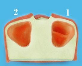 Modelo de práctica sinusal para implante dental - Product Image 3