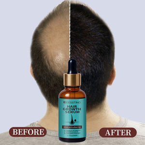 Suero para el Crecimiento Rápido del Cabello con Células Madre, Fortalece los Folículos Pilosos, Nutre el Cuero Cabelludo, Venta al Por Mayor - Product Image 2