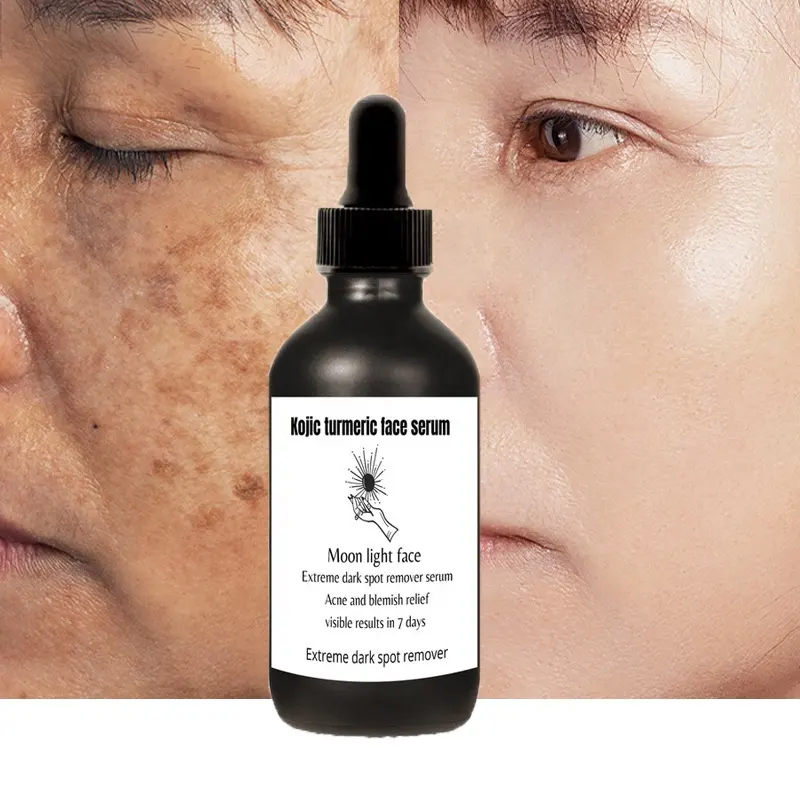 Kojic Kurkuma Gesichts serum, effektiver dunkle Flecken entferner, effektives Gesichts serum für Verblasst dunkle Flecken, Eigenmarke