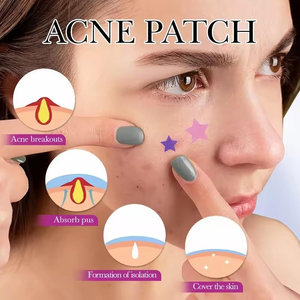 Patchs anti-boutons en forme d'étoile pour le visage avec hydrocolloïde, acide salicylique et arbre à thé, autocollants de guérison mignons en forme d'étoile pour les boutons - Product Image 4