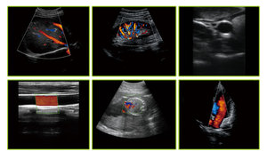 C5W 15inch 32/64 kênh LCD xách tay không dây kết nối tự do hoạt động máy tính xách tay siêu âm DOPPLER màu máy siêu âm - Product Image 5