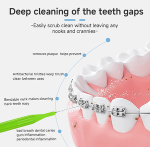 12 cái Interdental bàn chải chỉnh hình răng xỉa Răng Đầu chăm sóc răng miệng công cụ làm sạch loại bỏ mảng bám nha khoa <span class=keywords><strong>Flosser</strong></span> - Product Image 3