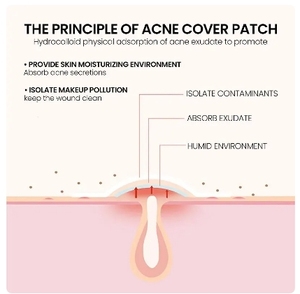 Parche reparador para acné, cuidado facial de la piel, manchas que se desvanecen, marcas de espinillas, cubierta cerrada para manchas de acné, parche de reparación de espinillas - Product Image 4
