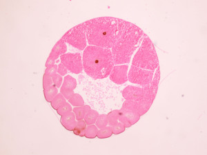 กล้องจุลทรรศน์เตรียมสไลด์ กล้องจุลทรรศน์สัตว์เตรียมสไลด์แมลง 13 ชิ้นชุดใช้ในโรงเรียนมัธยมต้น - Product Image 3