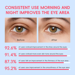 Crème pour les yeux QUIYUM 20g avec vitamine C, anti-rides, éclaircissante, réduction des cernes et des poches sous les yeux - Product Image 6