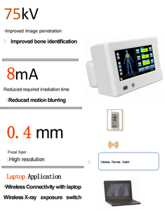 Machine à rayons X portable vétérinaire numérique 560W Système d'imagerie DR Machine à rayons X portable Équipement de radiologie DR - Product Image 3