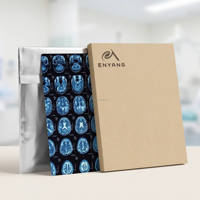 Mesin X-Ray, Film Inkjet Biru PVC, Film X-Ray Hurda, Film X-Ray NDT 10 x 48