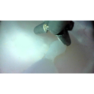 Modelo de Simulación para Entrenamiento en Ureteroscopia - Herramienta de Práctica de Endoscopia del Tracto Urinario para Educación Médica - Product Image 3