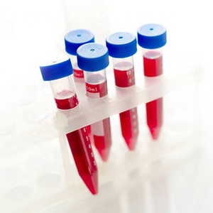 Tubo de Centrífuga de Laboratorio con Fondo Cónico de PP Graduado de 10 ml con Tapa de Rosca - Product Image 1