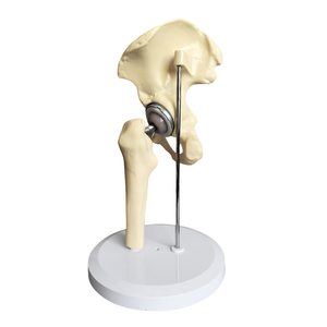 Modèle anatomique en silicone de remplacement d'articulation de la hanche pour la formation pré-chirurgicale en sciences médicales - Product Image 1