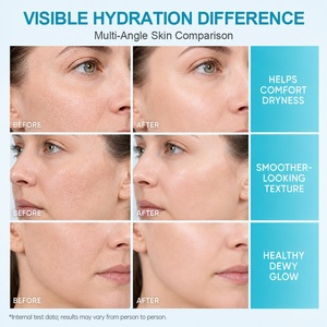 <span class=keywords><strong>Crema</strong></span> Facial <span class=keywords><strong>Hidratante</strong></span> Profunda Multi-Ceramida de Marca Privada, <span class=keywords><strong>Crema</strong></span> Facial Nutritiva Profunda de Día y <span class=keywords><strong>Noche</strong></span> para Piel Seca - Product Image 5